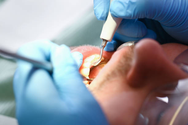 Best Tooth Infection Emergency Dentist  in Delavan, WI