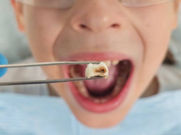 Best Urgent Tooth Repair  in Delavan, WI